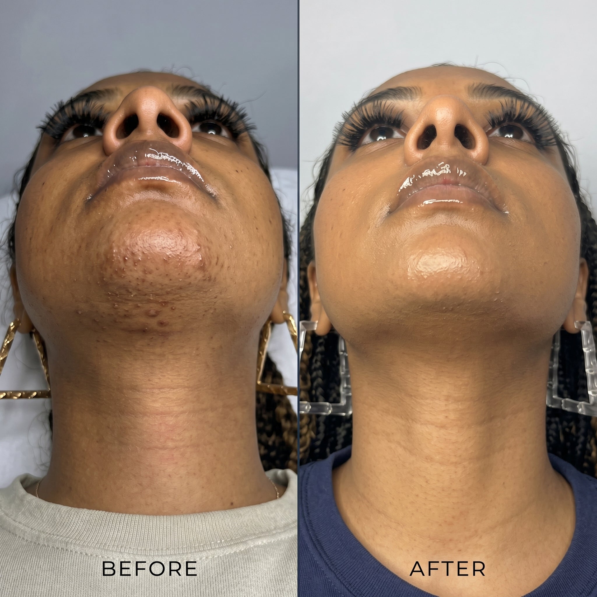 Layali Follicle Calm Oil (Buy 1 Get 1 Free) – Natural Hair Growth Inhibitor
